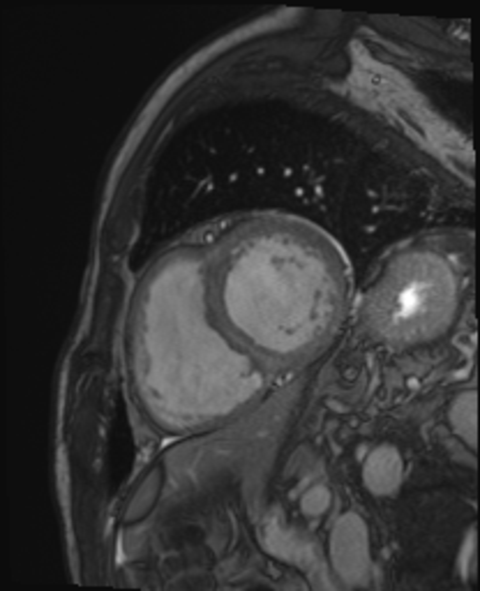 Magnetresonanztomographie Abbildung 2