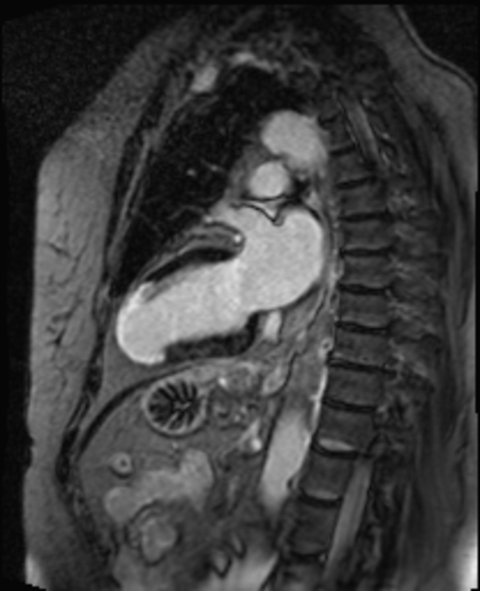 Magnetresonanztomographie Abbildung 3